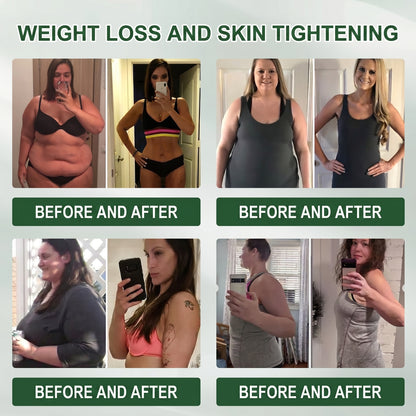 🧬𝐈𝐧𝐬𝐋𝐞𝐦𝐨𝐧® 𝗠𝗼𝗿𝗶𝗻𝗴𝗮 × 𝗕𝗲𝗿𝗯𝗲𝗿𝗶𝗻𝗲 × 𝗔𝗠𝗣𝗞 𝟭𝟬-𝗶𝗻-𝟭 𝗠𝗲𝘁𝗮𝗯𝗼𝗹𝗶𝗰 𝗦𝘂𝗽𝗽𝗼𝗿𝘁 𝗡𝗮𝗻𝗼 𝗠𝗶𝗰𝗿𝗼𝗻𝗲𝗲𝗱𝗹𝗲 𝗣𝗮𝘁𝗰𝗵 (𝐉𝐮𝐬𝐭 𝐨𝐧𝐜𝐞 𝐚 𝐝𝐚𝐲, 𝐯𝐢𝐬𝐢𝐛𝐥𝐞 𝐜𝐡𝐚𝐧𝐠𝐞𝐬 𝐢𝐧 𝟕 𝐝𝐚𝐲𝐬） ✅ 𝐅𝐨𝐫 𝐨𝐛𝐞𝐬𝐢𝐭𝐲, 🅛🅞🅞🅢🅔 🅢🅚🅘🅝,𝐝𝐢𝐚𝐛𝐞𝐭𝐞𝐬, 𝐬𝐥𝐞𝐞𝐩 𝐚𝐩𝐧𝐞𝐚, 𝐣𝐨𝐢𝐧𝐭 𝐢𝐬𝐬𝐮𝐞𝐬, 𝐚𝐧𝐝 𝐦𝐨𝐫𝐞