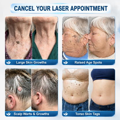 𝐇𝐈𝐒𝐊𝐈𝐍®👩‍⚕️ 𝐈𝐧𝐬𝐋𝐞𝐦𝐨𝐧® 🎁 WAIT! SPECIAL AUSSIE DEAL! ✨ Get yours today for almost free with an extra 30% OFF! ⏳🔥