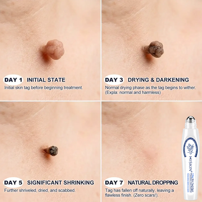 𝐇𝐈𝐒𝐊𝐈𝐍®👩‍⚕️ 𝐈𝐧𝐬𝐋𝐞𝐦𝐨𝐧® 🎁 WAIT! SPECIAL AUSSIE DEAL! ✨ Get yours today for almost free with an extra 30% OFF! ⏳🔥